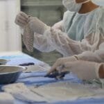 Pele de tilápia é utilizada para auxiliar na cicatrização de queimaduras e outros ferimentos