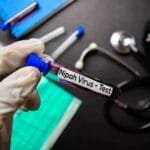 O vírus Nipah inspirou o filme de Hollywood “Contágio”