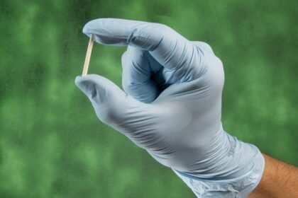 Mão com luva médica segura um implante subdérmico contraceptivo Implanon, método de longa duração utilizado para prevenção da gravidez.