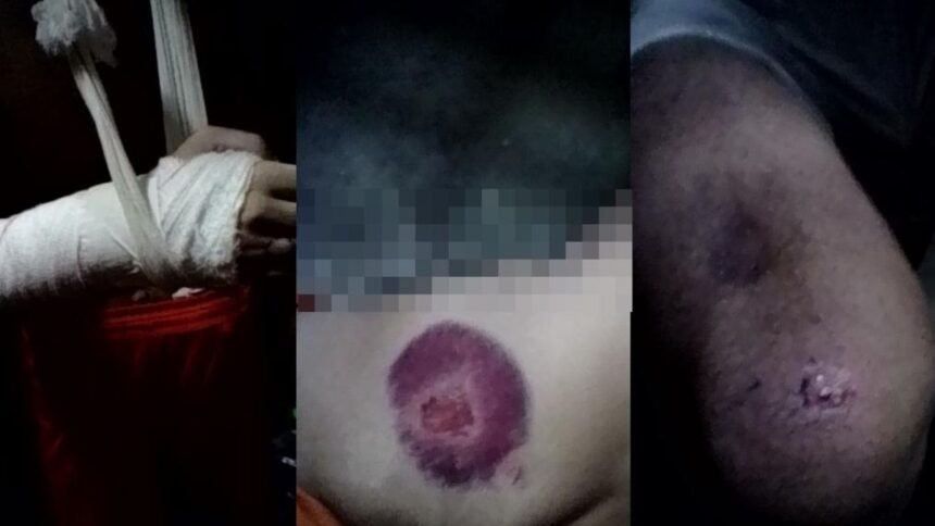 A imagem reúne registros que evidenciam marcas de agressões em diferentes partes do corpo de detentos da UPECT, como braços, pernas, costas e região do tronco, incluindo hematomas extensos e ferimentos abertos.