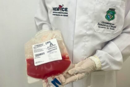 Profissional do Hemoce segura bolsa com células-tronco hematopoiéticas utilizadas em transplante de medula óssea no Ceará.