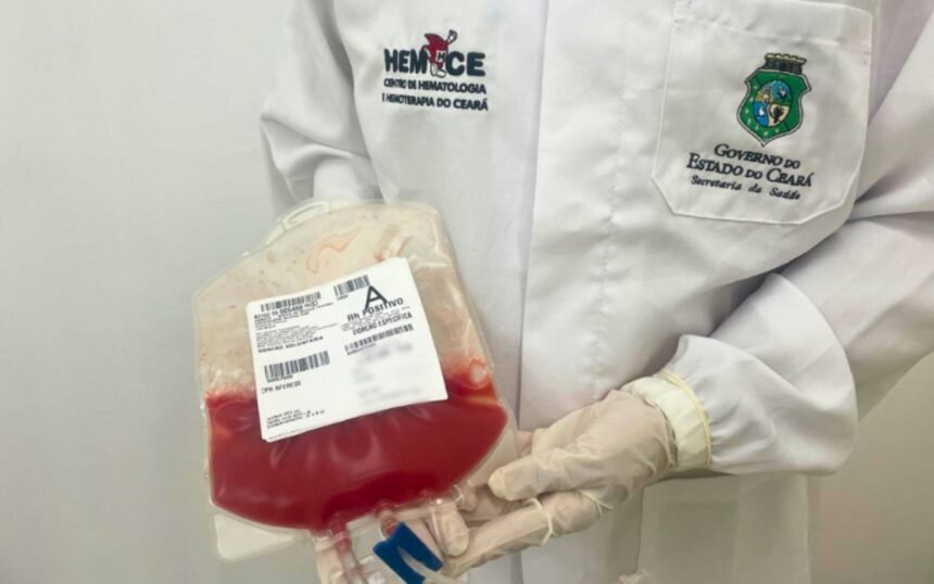 Profissional do Hemoce segura bolsa com células-tronco hematopoiéticas utilizadas em transplante de medula óssea no Ceará.